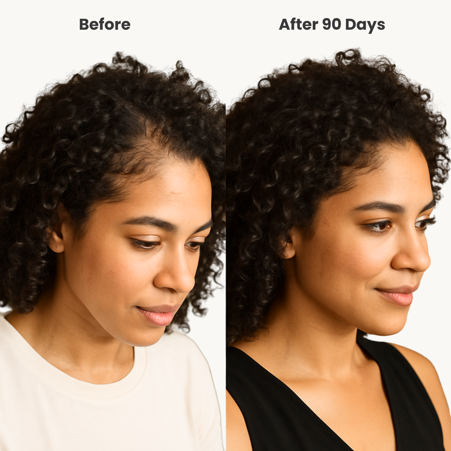 VLUMX Before and after comparison of a woman's hair growth over 90 days.